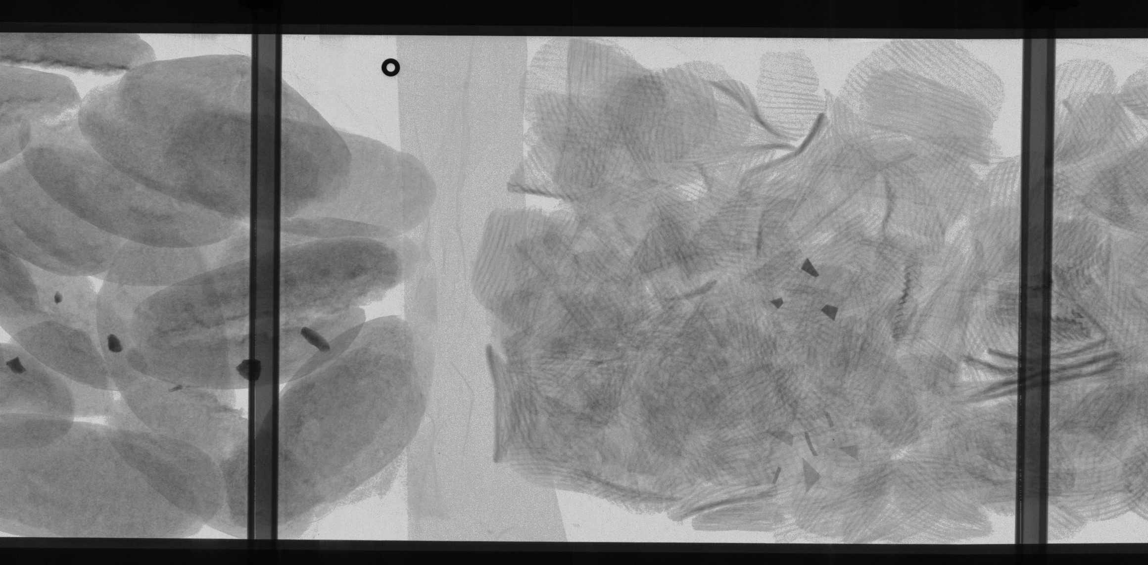 Chips and sugar bread X-ray