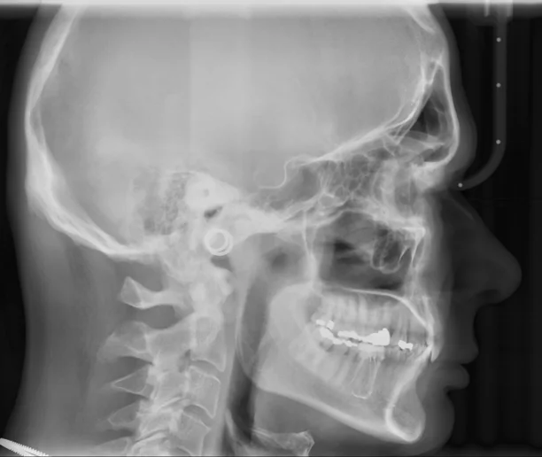 Ultra-Fast Scanning Sensor cephalo X-ray 1