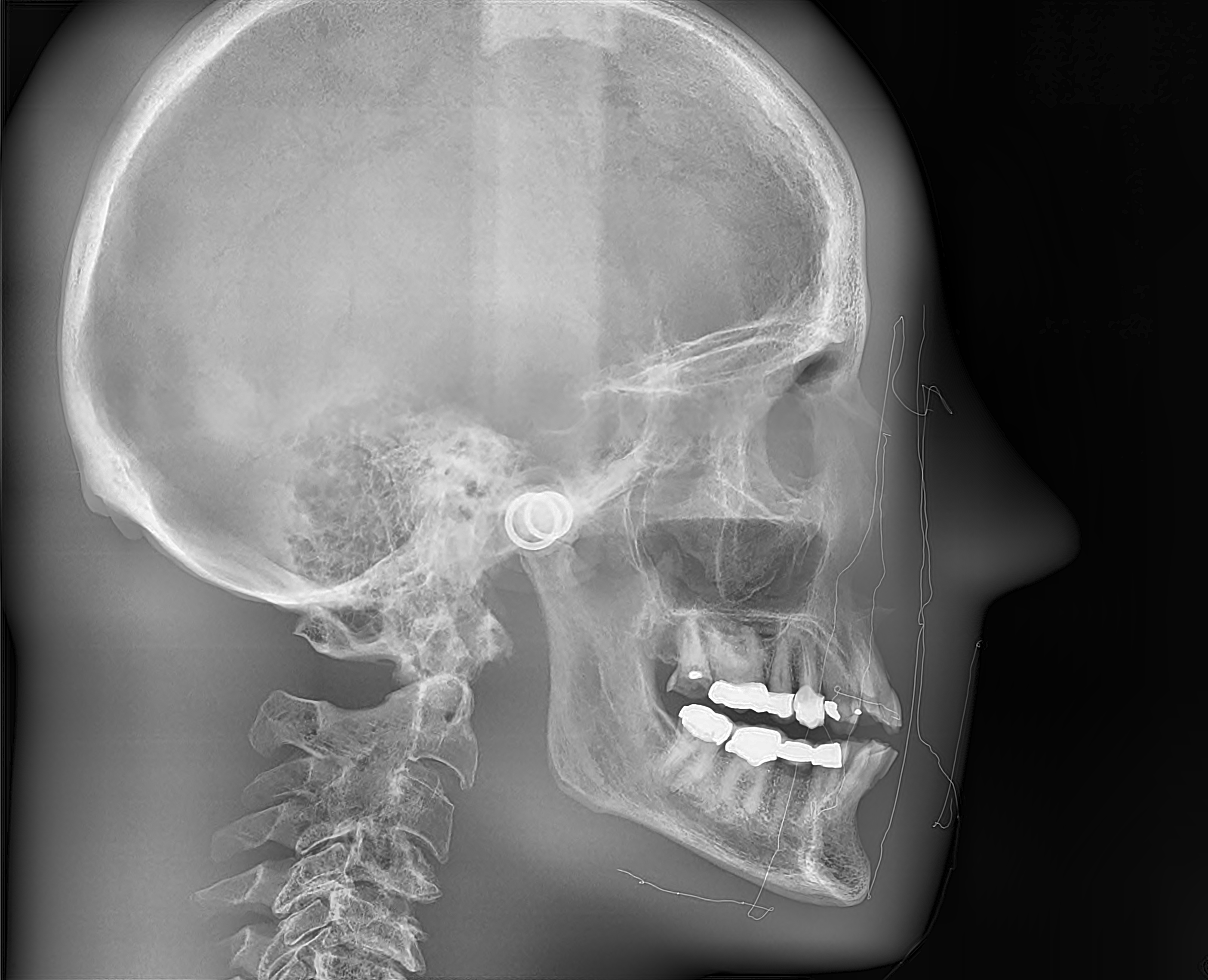 Ultra-Fast Scanning Sensor cephalo X-ray 1