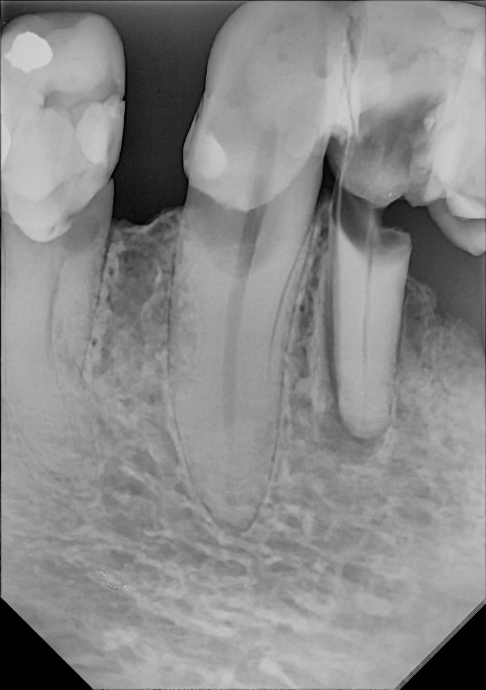 DC-Air anterior X-ray 7