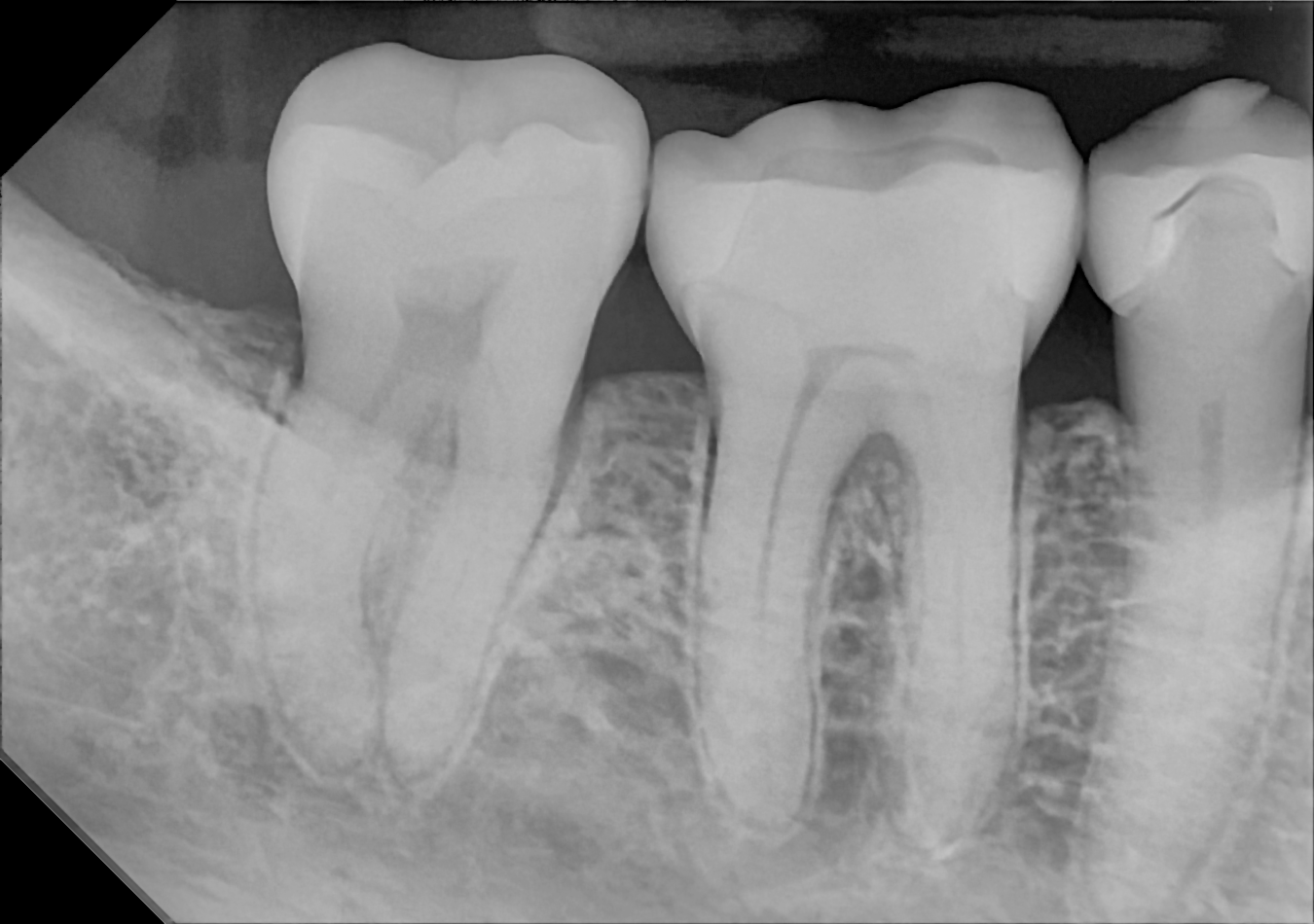 DC-Air posterior X-ray 8